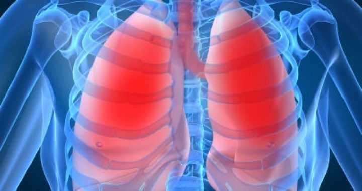 Bệnh phù phổi cấp – Chia sẻ kiến thức chăm sóc và bảo vệ sức khỏe người tiêu dùng