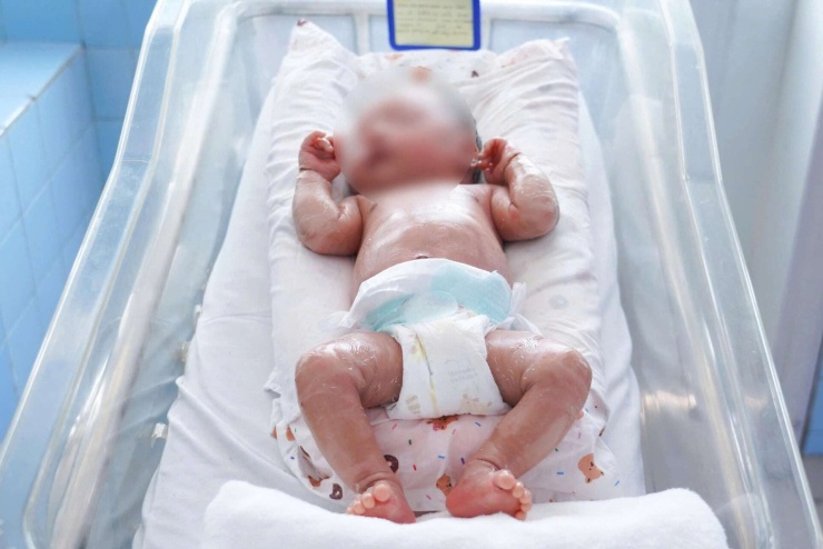 Bé sơ sinh mắc bệnh vảy cá — cảnh báo bệnh vảy cá ở trẻ sơ sinh