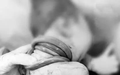 Bé gái chào đời an toàn — kỳ tích 5 vòng dây rốn quấn cổ