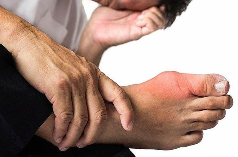 Người bệnh gout chế biến món ăn lành mạnh — phương pháp luộc, hấp giúp kiểm soát purin