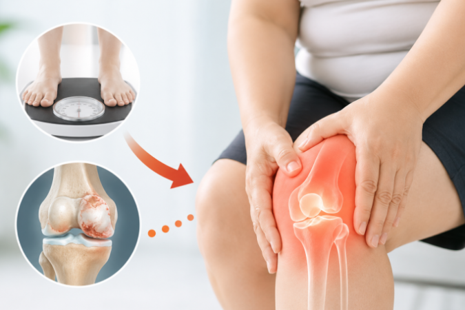 Dấu Hiệu Thoái Hóa Khớp Gối Diễn Tiến Âm Thầm: Phát Hiện Sớm Để Tránh Nguy Cơ Tàn Phế