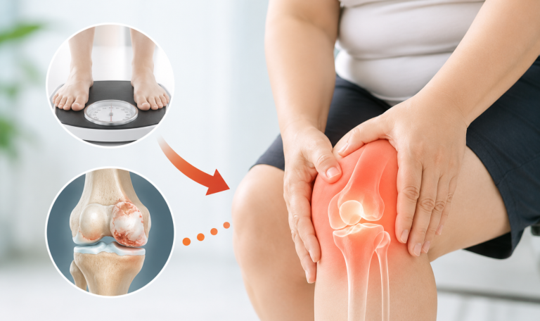 Dấu Hiệu Thoái Hóa Khớp Gối Diễn Tiến Âm Thầm: Phát Hiện Sớm Để Tránh Nguy Cơ Tàn Phế