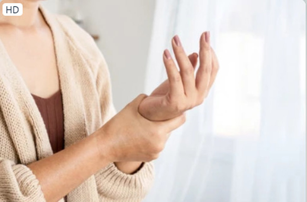 Minh họa cảm giác tê nhức tay đột ngột do dây thần kinh bị chèn ép